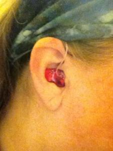 Red is a lovely color for an ear mold, as @MsDrPepper on Twitter demonstrates with her hearing aid.