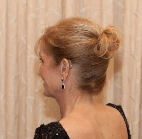 Marilyn shows off her Oticon Agil Pro hearing aids at her daughter's wedding. She has worn them since 2004.