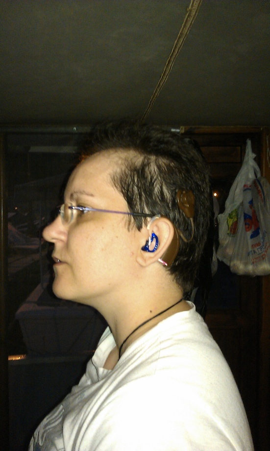 Vivie Moraiti continues the royal blue ear mold trend with her Cochlear Freedom implant. She's worn it for five years. 