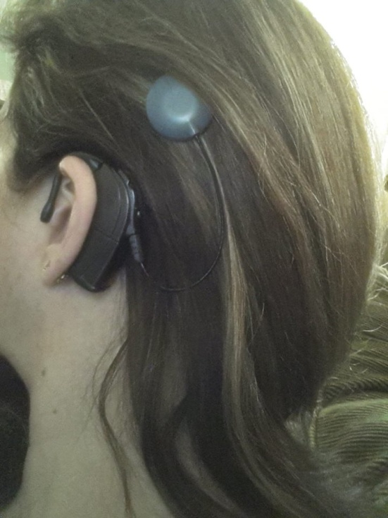 Stephanie Georgel shows off her cochlear implant and gorgeous thick hair. Beautiful!