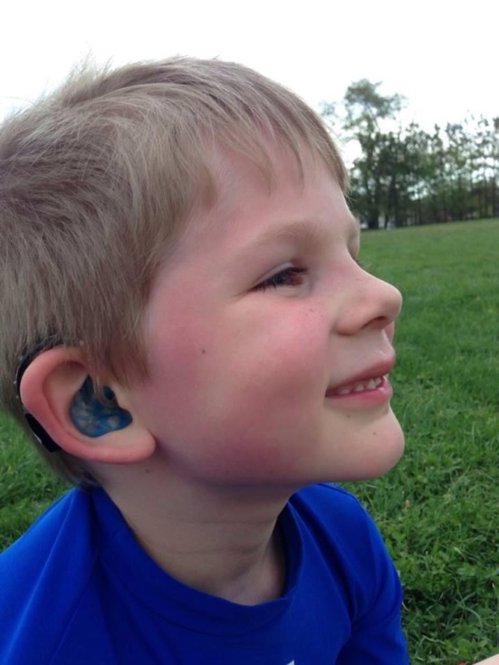 Six-year-old Matthew wears blue ear molds (and a precious smile).