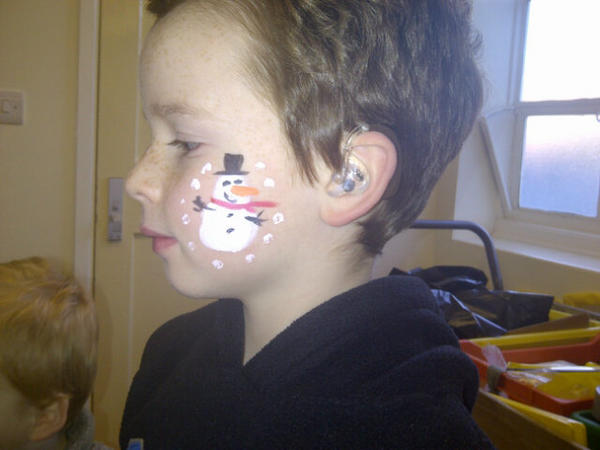 Niall, 7, has been wearing hearing aids since the age of 16 months old. His ear molds feature a Batman design. Cute Snowman, too! 